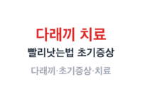 다래끼 치료 썸네일
